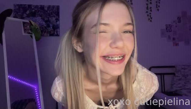 Braces Babe